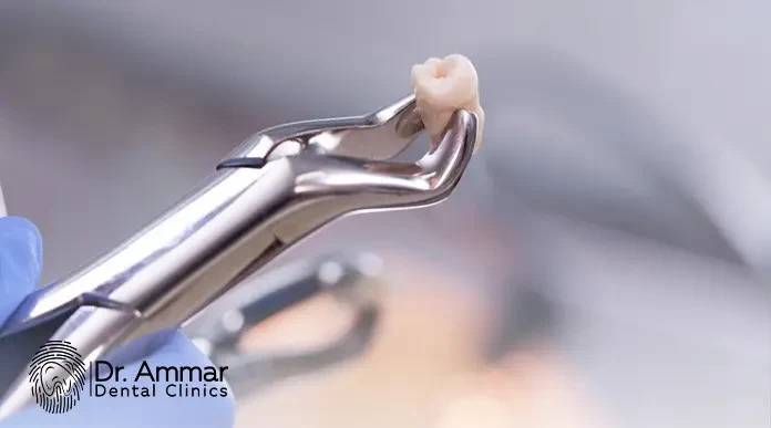 How Much Does Tooth Extraction Cost in Egypt