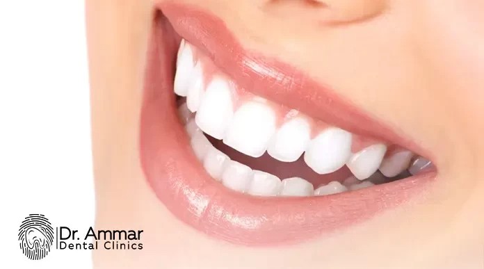 سعر ابتسامة هوليود في السعودية