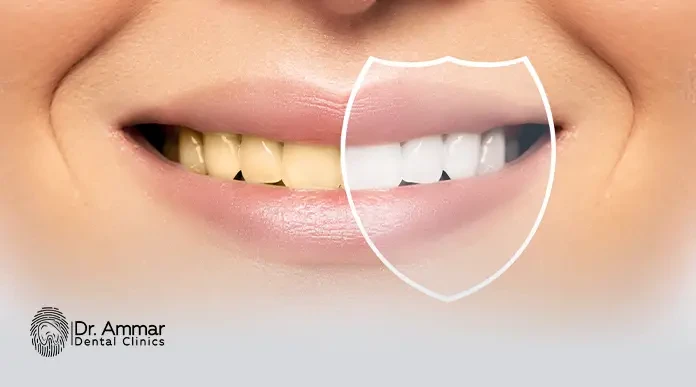 Teeth whitening methods