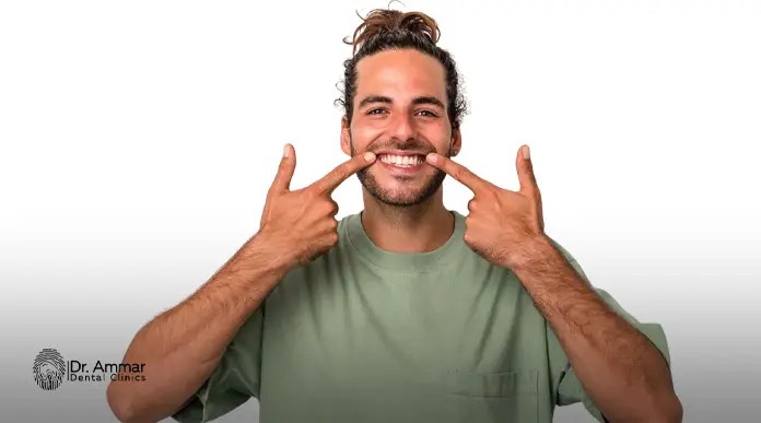 Types of dental veneers
