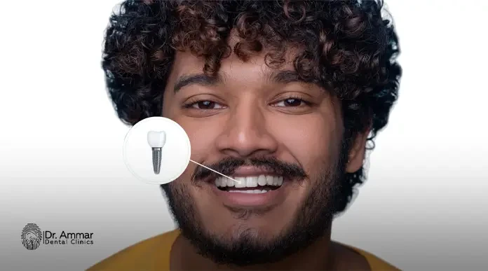 ايماكس سويسري