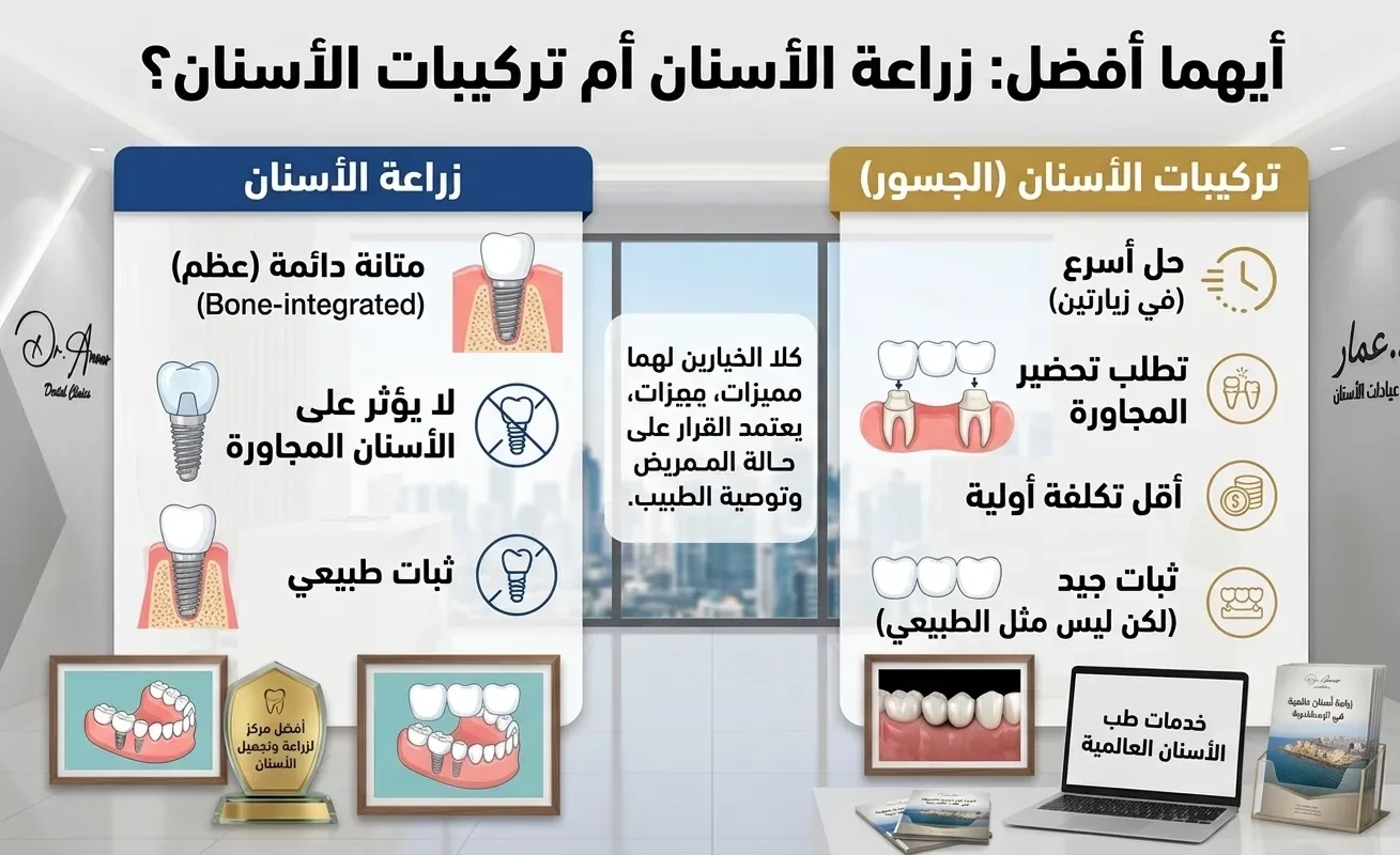 Which is better: dental implants or dental prosthetics?