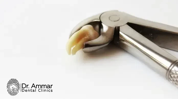 The Latest Techniques in Tooth Extraction