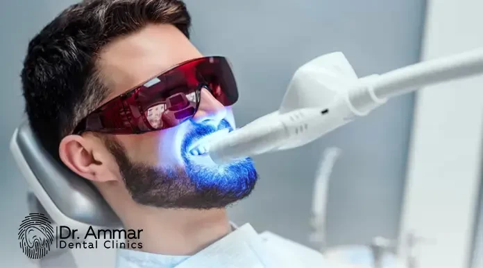 Laser Teeth Whitening in Egypt