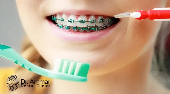 Orthodontic Brush
