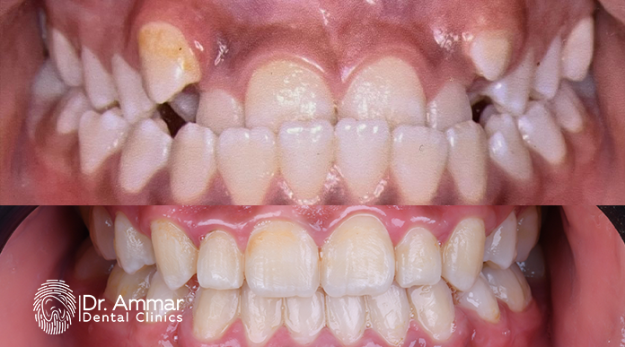 Your comprehensive guide to orthodontics