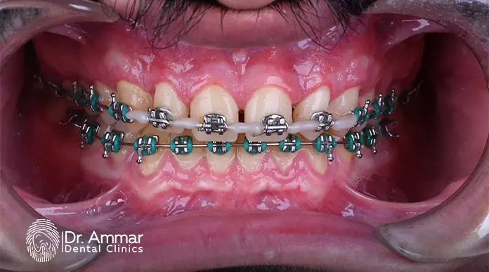 Orthodontics